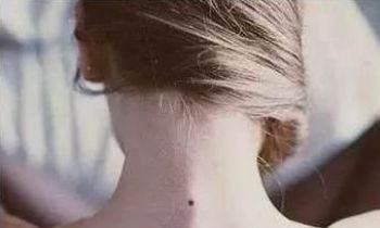 脖子后面有痣好吗，脖子后面的苦情痣有什么说法