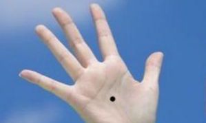 掌心痣是福是祸，看完这三点，再决定要不要点痣