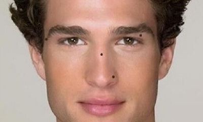 男人面部痣相图解 额头长痣预示一生福禄享之不尽