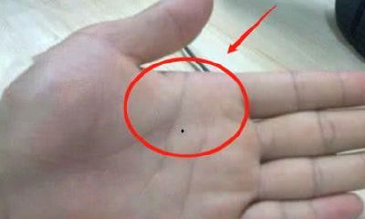 聚财进财痣指的是什么