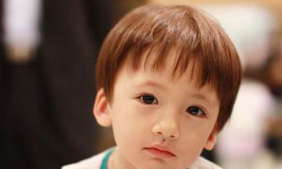 小孩人中长痣好不好