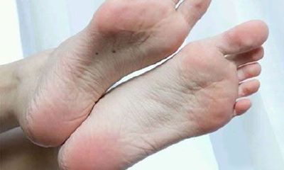 右脚底两颗痣代表什么