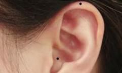 无论男女，身上有这4颗痣，必是富贵双全，啥也不愁