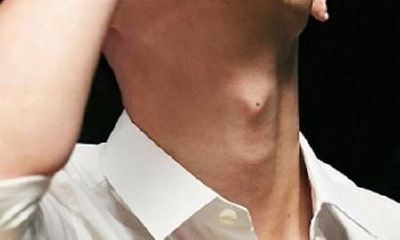 痣的位置：喉结