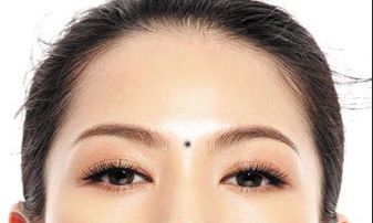 印堂长斑是什么原因