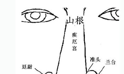 痣的位置：山根