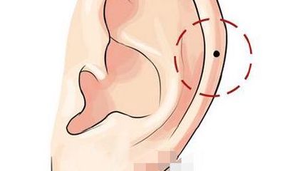 偏财痣在哪，偏财痣的位置