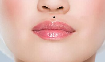 人体面相痣相：双生痣