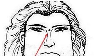 身体此处长恶痣，典型的小人痣