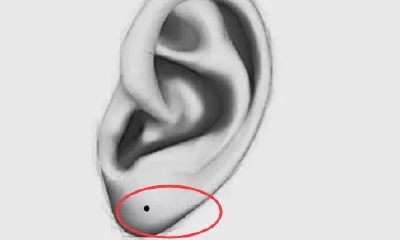 脸上不能留的四处恶痣，招惹小人，漏财散财痣