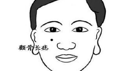 什么位置是旺财痣