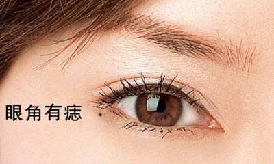 脸上这几个位置有痣的人必定会大富大贵福禄双全