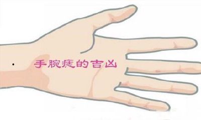 手腕有痣义薄云天