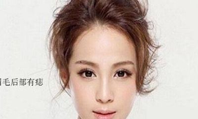 身上这几处痣长毛，预示着你能够大富大贵