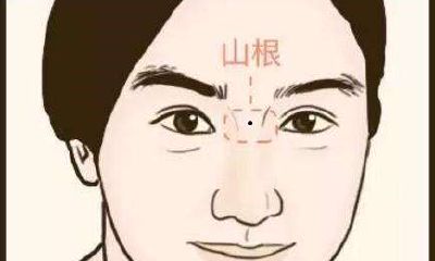 山根有痣怎么化解