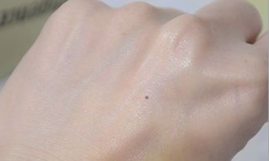 手背上长痣代表什么