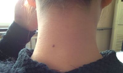 男人苦情痣长在哪里