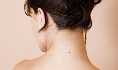 苦情痣是什么意思