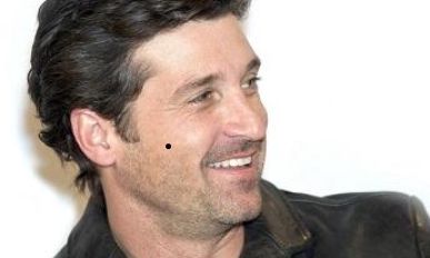 右脸上长痣面相图