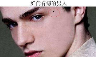 男人什么地方长痣不好