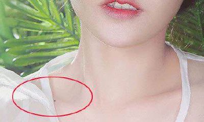 女人这三颗痣越黑越好 绝对会好命