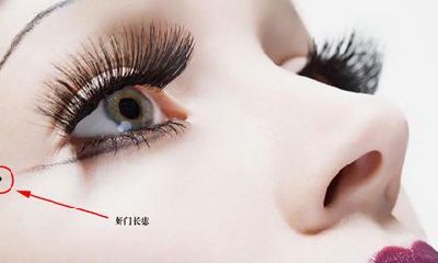 好坏四种痣，前者有钱有势，后者倒霉一生