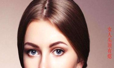 最有福气的吉痣女人_女人幸运吉痣介绍