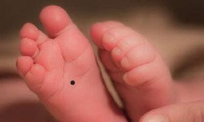 脚上有痣代表什么 脚上有痣好不好