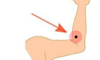 手臂有痣的女人命运好吗