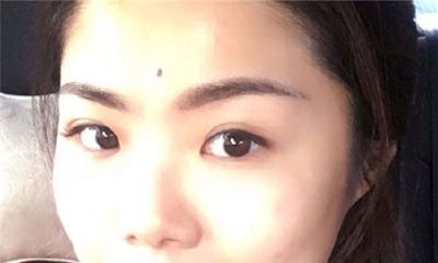 印堂有痣好吗，是吉还是凶