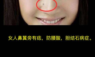 女人鼻翼旁有痣
