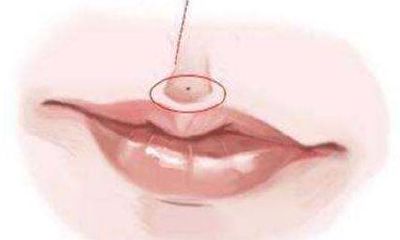 女人人中有痣相学介绍 人中有痣你怎么看