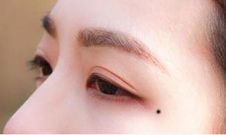 眼尾痣的位置与命运_眼尾痣怎么样