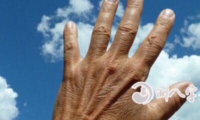 生命线断开错位又延伸的手相运势怎样