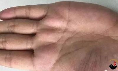 看手知健康，手纹不撒谎，心肌梗塞手纹长啥样，预防猝死自我急救