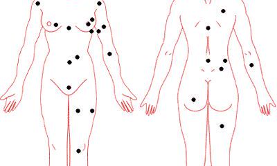 女人全身痣相图解