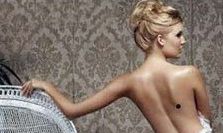 背上有痣好不好 背上长痣有什么说法？