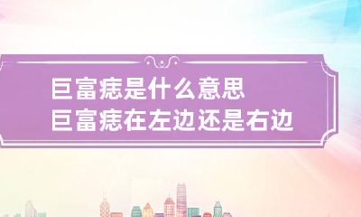 巨富痣是什么意思 巨富痣在左边还是右边