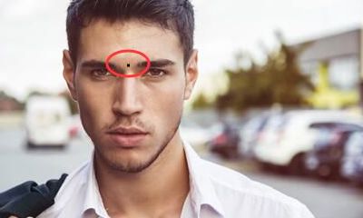 这些位置上长痣的男性容易出轨