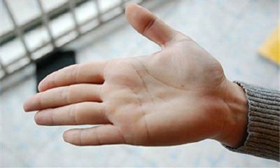 男人哪里长肉最旺运