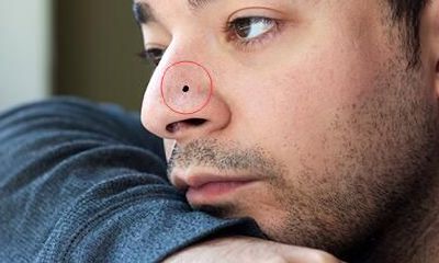 有这些痣的男人在工作情感中靠不住