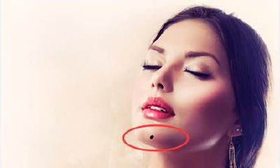 代表着能够发财的痣相有哪些