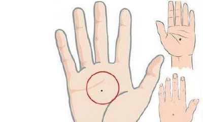 手中长有痣有着哪些含义特征