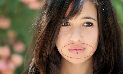 面部中哪些痣相预示着个人的健康状况下滑