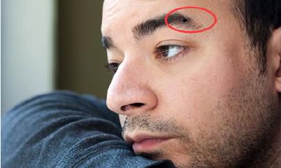 男性眉毛中长有痣有着怎样的特殊含义