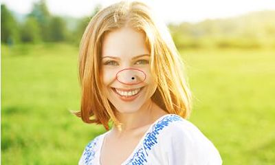 容易遭遇破财霉运的痣都有哪些