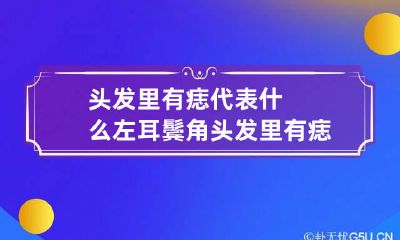 头发里有痣代表什么 左耳鬓角头发里有痣代表什么