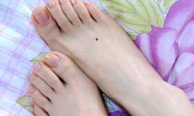 女生脚背长痣富贵图解 都有哪些含义