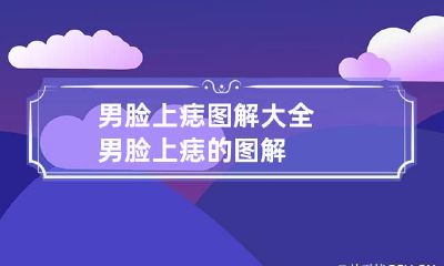男脸上痣图解大全 男脸上痣的图解