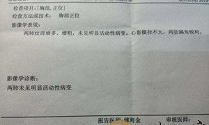 梦见体检不合格